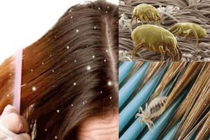 How to avoid head lice